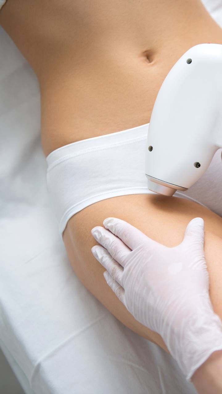 Laserhaarentfernung Bikini bei STELLAR Beauty Studio Nürnberg